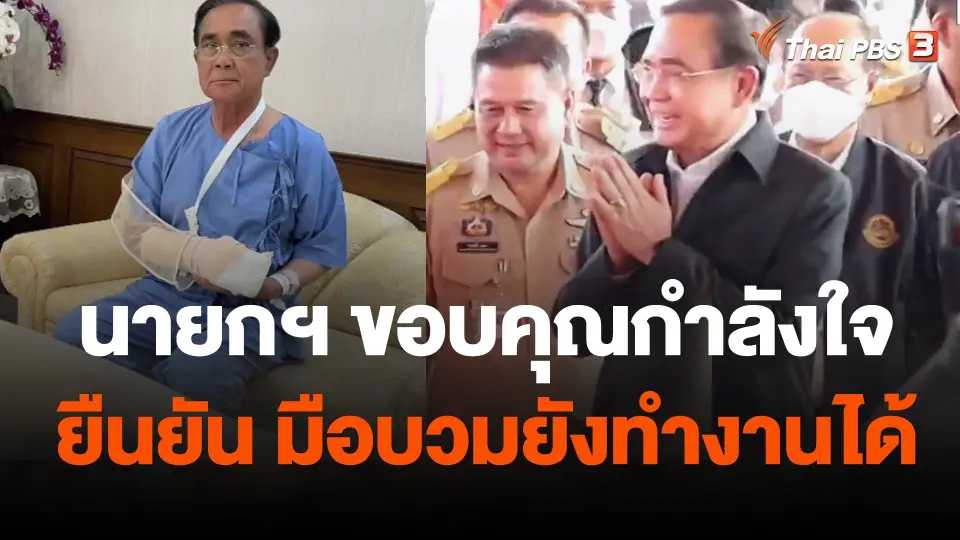นายกฯ ขอบคุณกำลังใจ ยืนยัน มือบวมยังทำงานได้