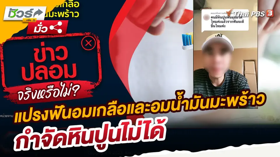 ชัวร์หรือมั่ว : ทันตแพทย์ชี้! แปรงฟันอมเกลือและอมน้ำมันมะพร้าวกำจัดหินปูนไม่ได้