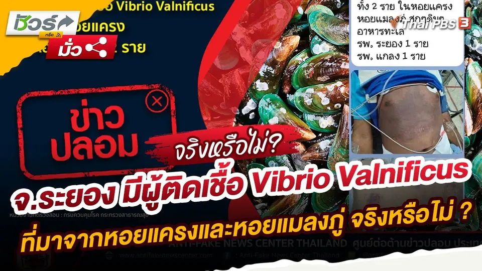 ​ชัวร์หรือมั่ว : จ.ระยอง มีผู้ติดเชื้อ Vibrio Valnificus ที่มาจากหอยแครงและหอยแมลงภู่ 2 ราย จริงหรือไม่ ?