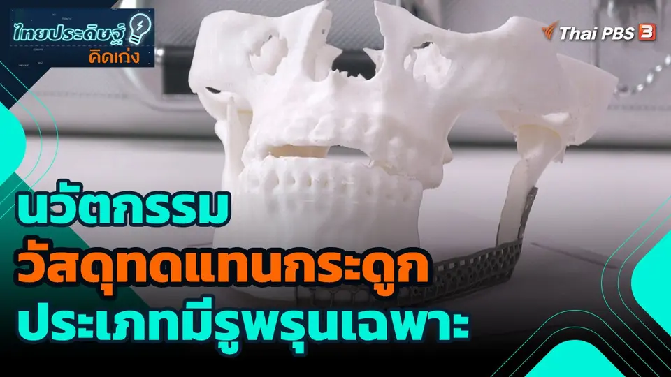 ​ไทยประดิษฐ์คิดเก่ง : นวัตกรรมวัสดุทดแทนกระดูก ประเภทมีรูพรุนเฉพาะ