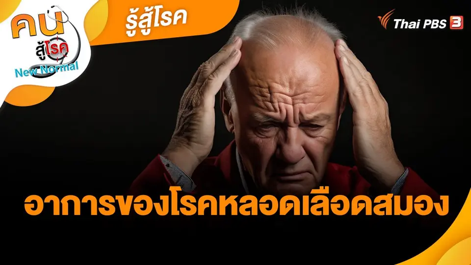 รู้สู้โรค : อาการของโรคหลอดเลือดสมอง