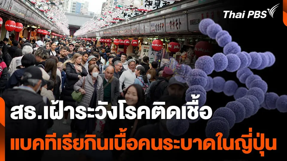 สธ.เฝ้าระวังโรคติดเชื้อ "สเตรปโตคอคคัส" ระบาดในญี่ปุ่น
