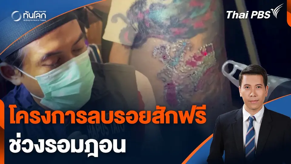 โครงการลบรอยสักฟรีช่วงรอมฎอน