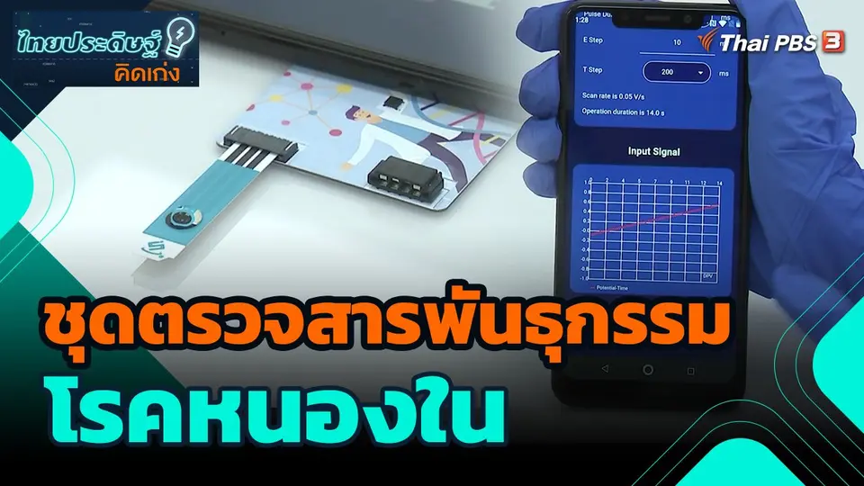 ไทยประดิษฐ์คิดเก่ง : ชุดตรวจสารพันธุกรรมโรคหนองใน