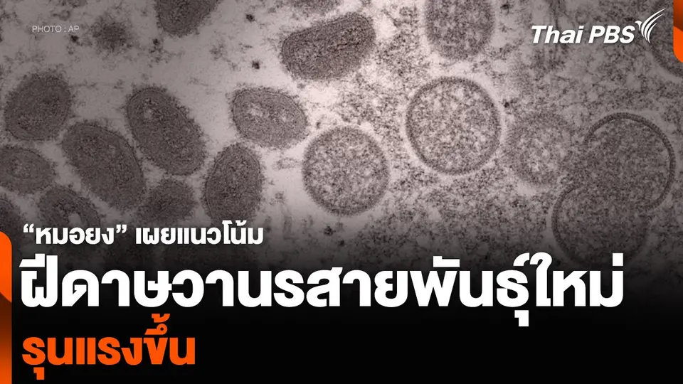 “หมอยง” เผยแนวโน้มฝีดาษวานรสายพันธุ์ใหม่ รุนแรงขึ้น