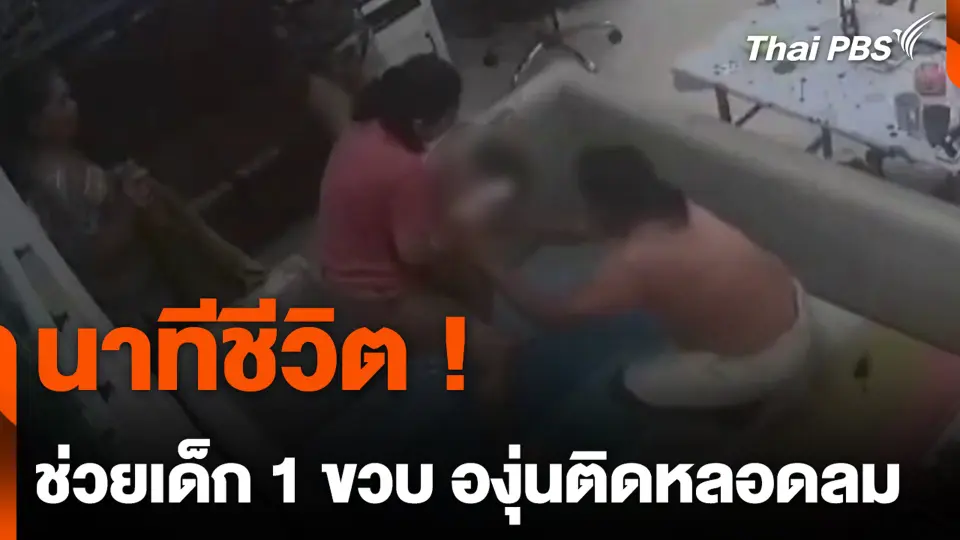 นาทีชีวิต ! ช่วยเด็ก 1 ขวบ องุ่นติดหลอดลม