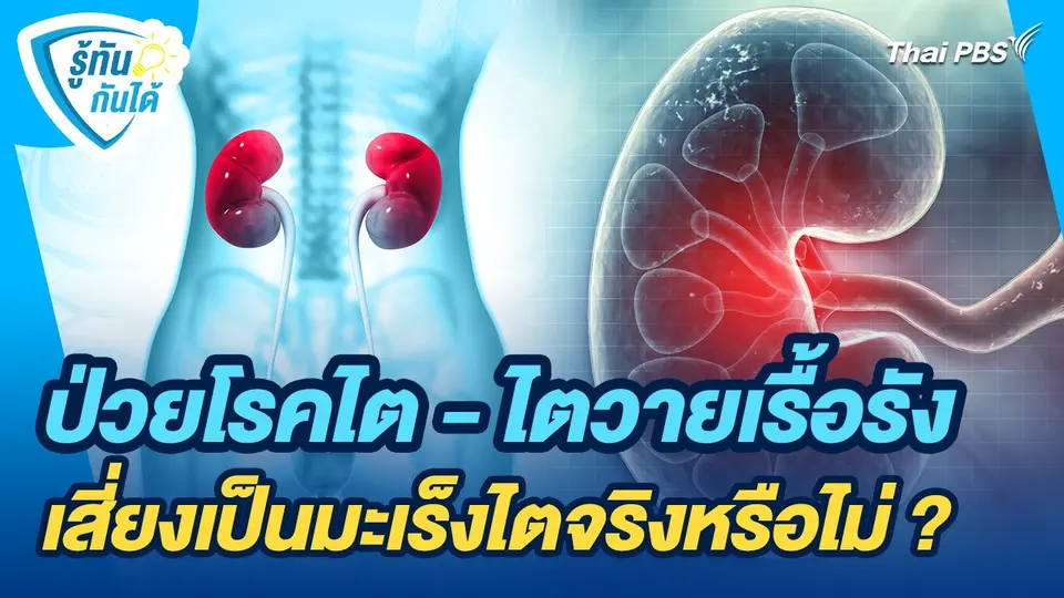 รู้ทันกันได้ : ป่วยโรคไต - ไตวายเรื้อรัง เสี่ยงเป็นมะเร็งไตจริงหรือไม่ ?
