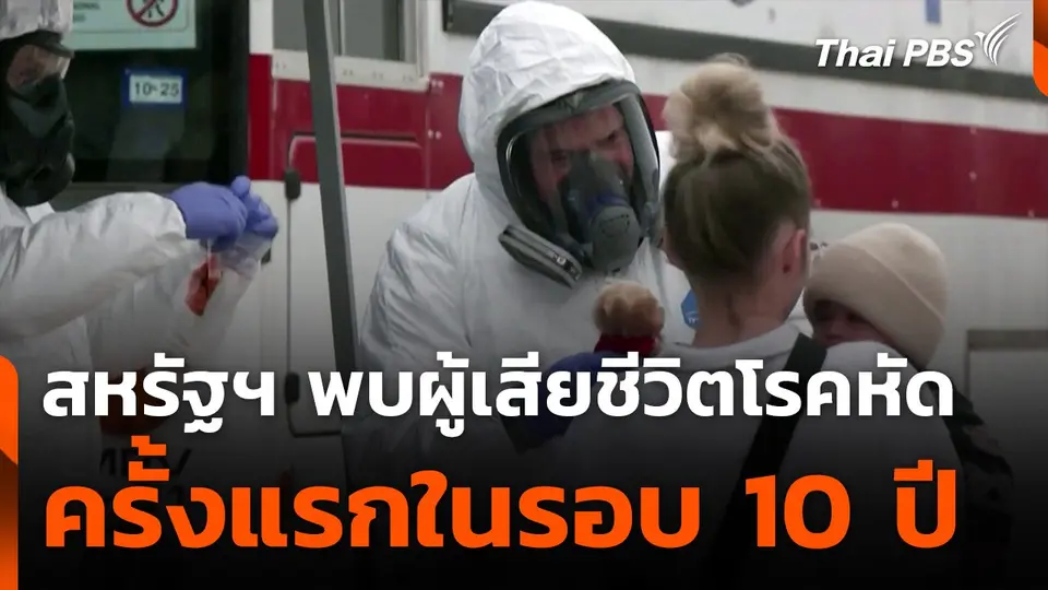 สหรัฐฯ พบผู้เสียชีวิตโรคหัดครั้งแรกในรอบ 10 ปี