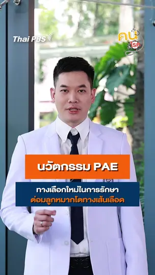 ​รู้จัก “PAE” ทางเลือกรักษาต่อมลูกหมากโตไม่ต้องผ่าตัด