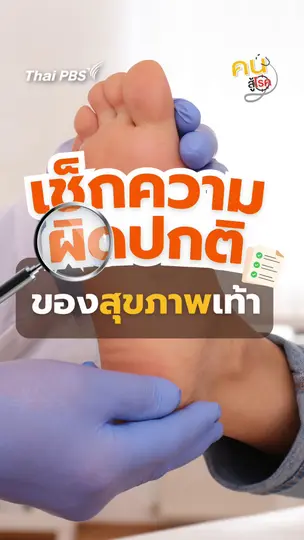 ​เช็กสุขภาพเท้าง่าย ๆด้วยการพิมพ์เท้า | #คนสู้โรค