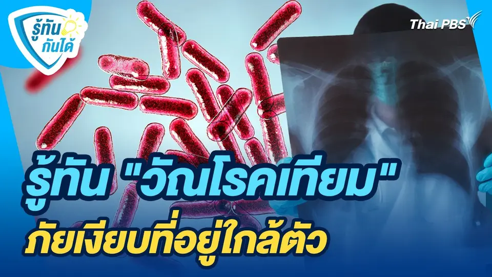 รู้ทันกันได้ : รู้ทัน "วัณโรคเทียม" ภัยเงียบที่อยู่ใกล้ตัว