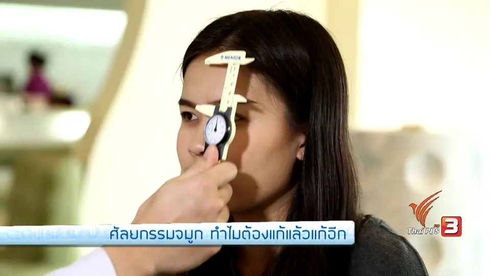 ศัลยกรรมจมูก ทำไมต้องแก้แล้วแก้อีก, ตามรอยเส้นทางผ้าเมืองลำพูน