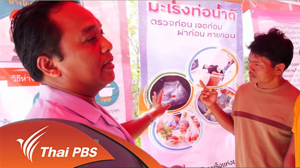 ตรวจคัดกรองมะเร็งท่อน้ำดี
