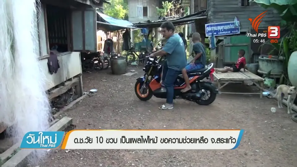 ดช.วัย 10 ขวบ เป็นแผลไฟไหม้ ขอความช่วยเหลือ จ.สระแก้ว