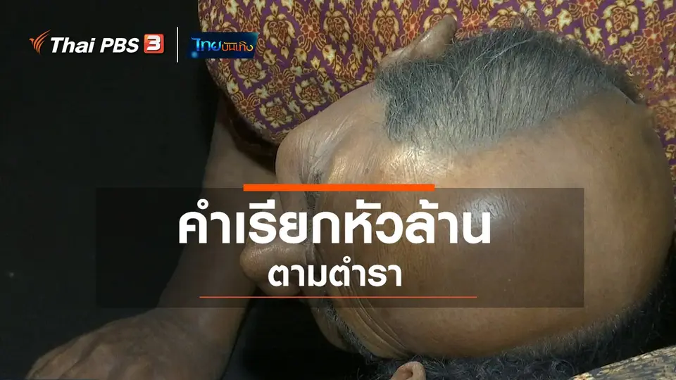 เพียงคำเดียว : คำเรียกหัวล้านตามตำรา