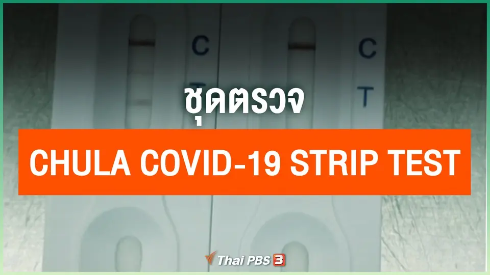 ชุดตรวจ Chula COVID-19 Strip Test