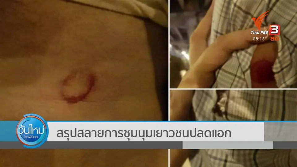 ​สรุปสลายการชุมนุมเยาวชนปลดแอก