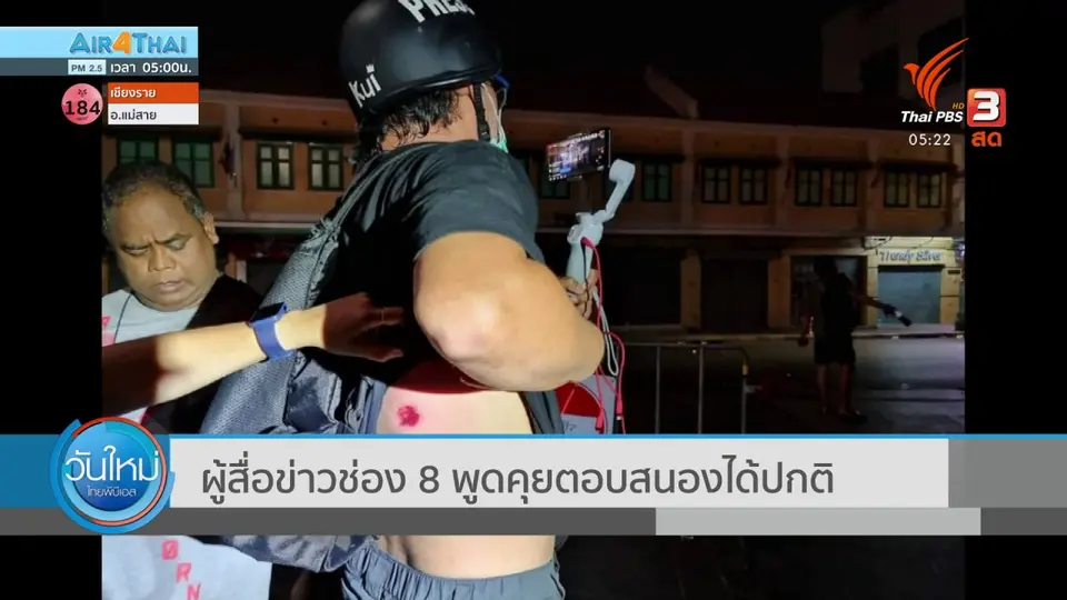 ผู้สื่อข่าว ถูกกระสุนยางยิง พูดคุยตอบสนองได้ปกติ