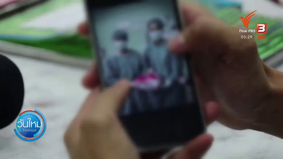 ผ่าตัดช่วยเด็ก 12 ปี ป่วยเนื้องอกรังไข่