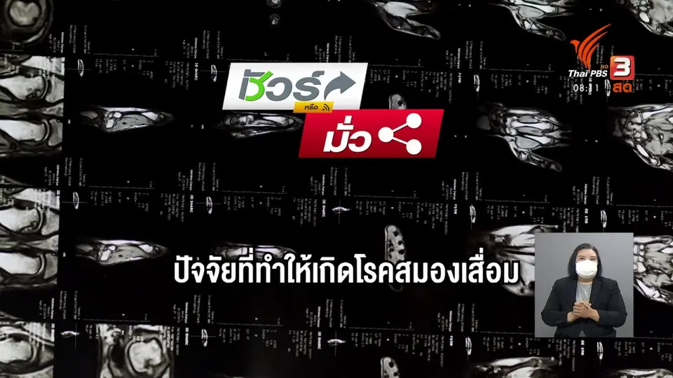 ​ชัวร์หรือมั่ว : ท่าบริหารมือป้องกันโรคสมองเสื่อม ?