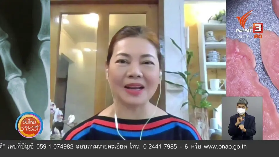 ชัวร์หรือมั่ว : โรคเกาต์ไม่ได้เกิดจากการกินไก่ปริมาณมาก ?