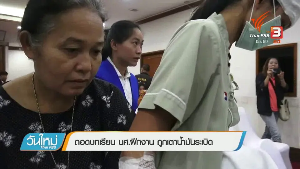 ถอดบทเรียน นศ.ฝึกงานถูกเตาน้ำมันระเบิด