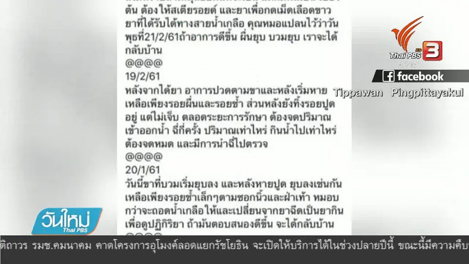 เฝ้าระวัง "ฮีน็อค" โรคเส้นเลือดฝอยอักเสบในเด็ก