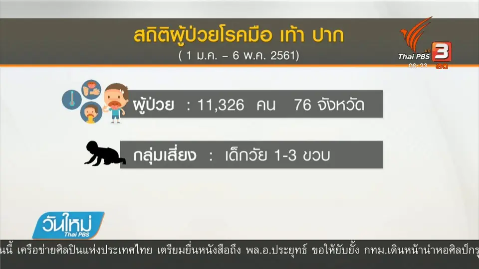 สธ.พบผู้ป่วยโรคมือ เท้า ปาก กว่า 10,000 คน