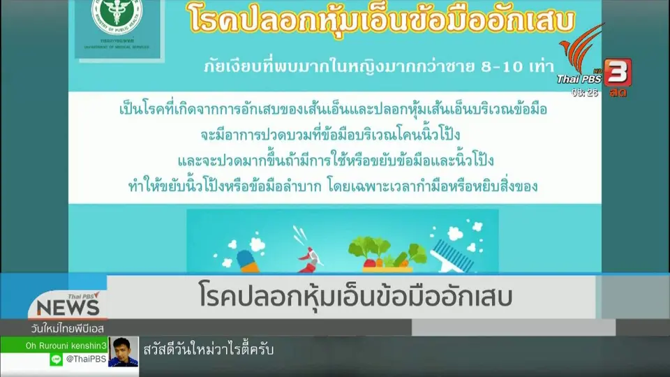 จับตาข่าวเด่น : โรคปลอกหุ้มเอ็นข้อมืออักเสบ ผู้หญิงเสี่ยงเป็นมากกว่าผู้ชาย 10 เท่า