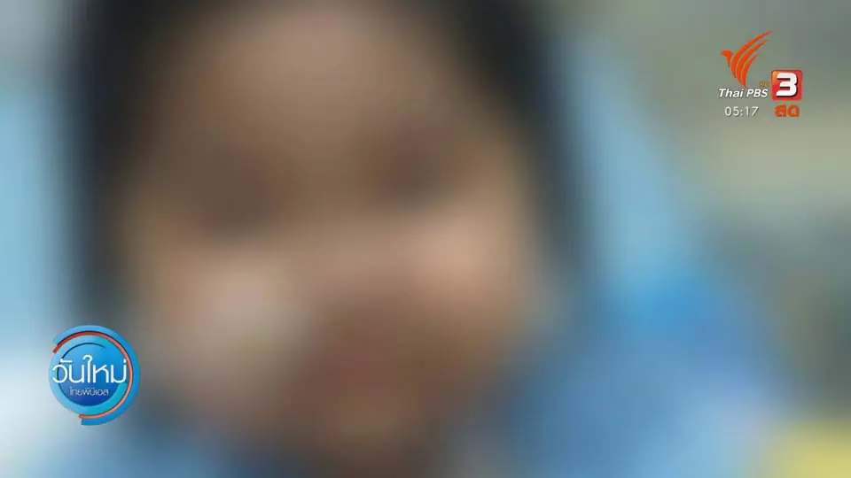 ​แพทย์พบพิรุธอาการเด็ก "ได้รับสารพิษ"