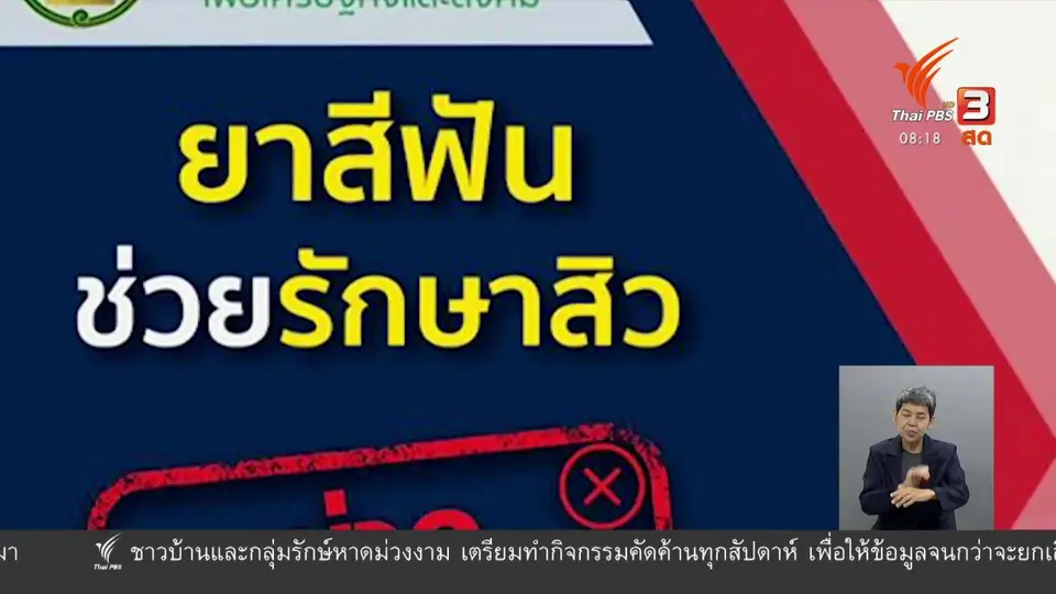 ​จับตาข่าวเด่น​ : ข่าวปลอม ยาสีฟันรักษาสิวได้