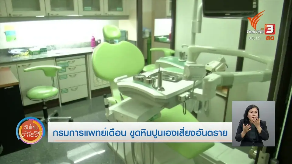 ​จับตาข่าวเด่น​ : กรมการแพทย์ เตือนขูดหินปูนเองเสี่ยงอันตราย