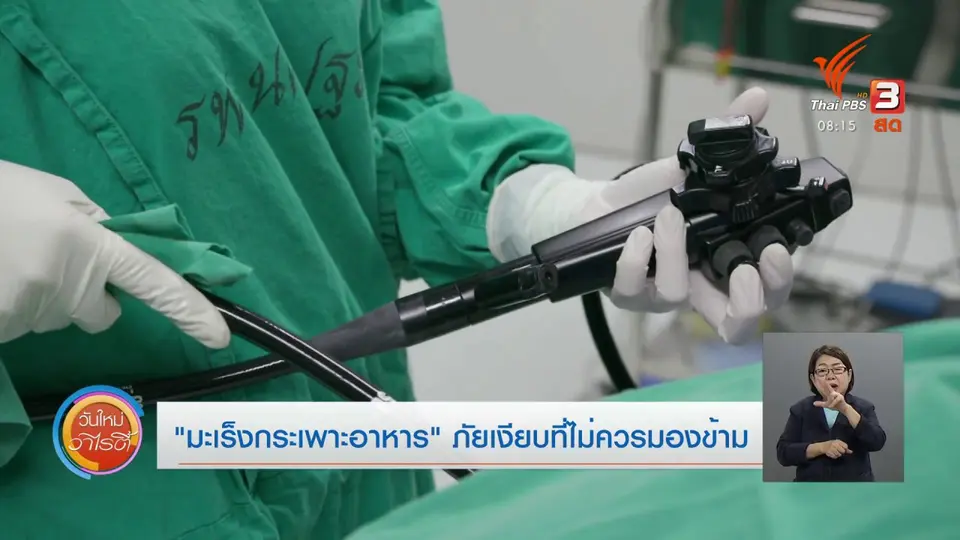 จับตาข่าวเด่น : “มะเร็งกระเพาะอาหาร” ภัยเงียบที่ไม่ควรมองข้าม