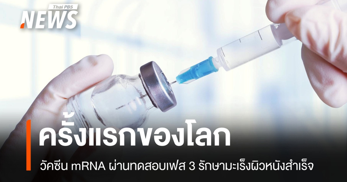 ครั้งแรกของโลก! วัคซีน mRNA ผ่านทดสอบเฟส 3 รักษามะเร็งผิวหนังสำเร็จ