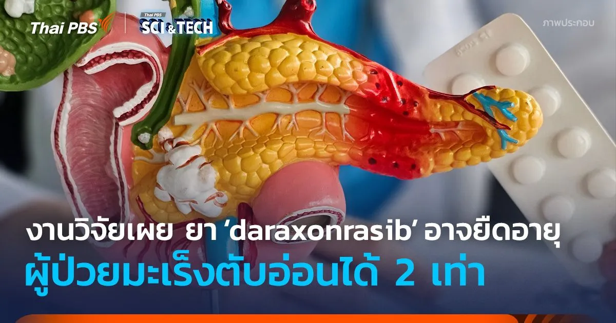 งานวิจัยเผย ยา ‘daraxonrasib’ อาจยืดอายุผู้ป่วยมะเร็งตับอ่อนได้ 2 เท่า