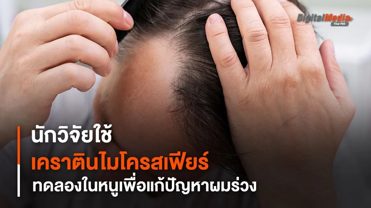 นักวิจัยใช้ "เจลเคราตินไมโครสเฟียร์" ทดลองปลูกขนหนู เพื่อแก้ปัญหาผมร่วง