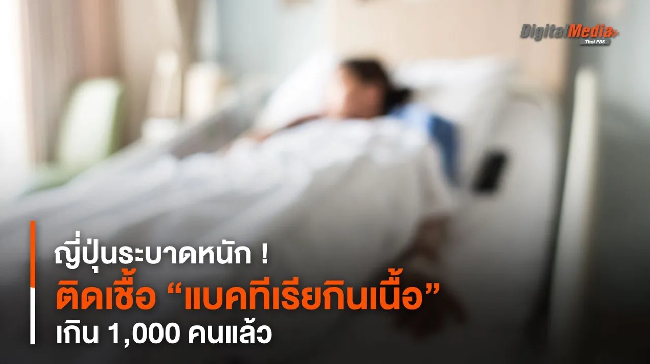 ญี่ปุ่นระบาดหนัก ! ติดเชื้อ “แบคทีเรียกินเนื้อ” เกิน 1,000 คน