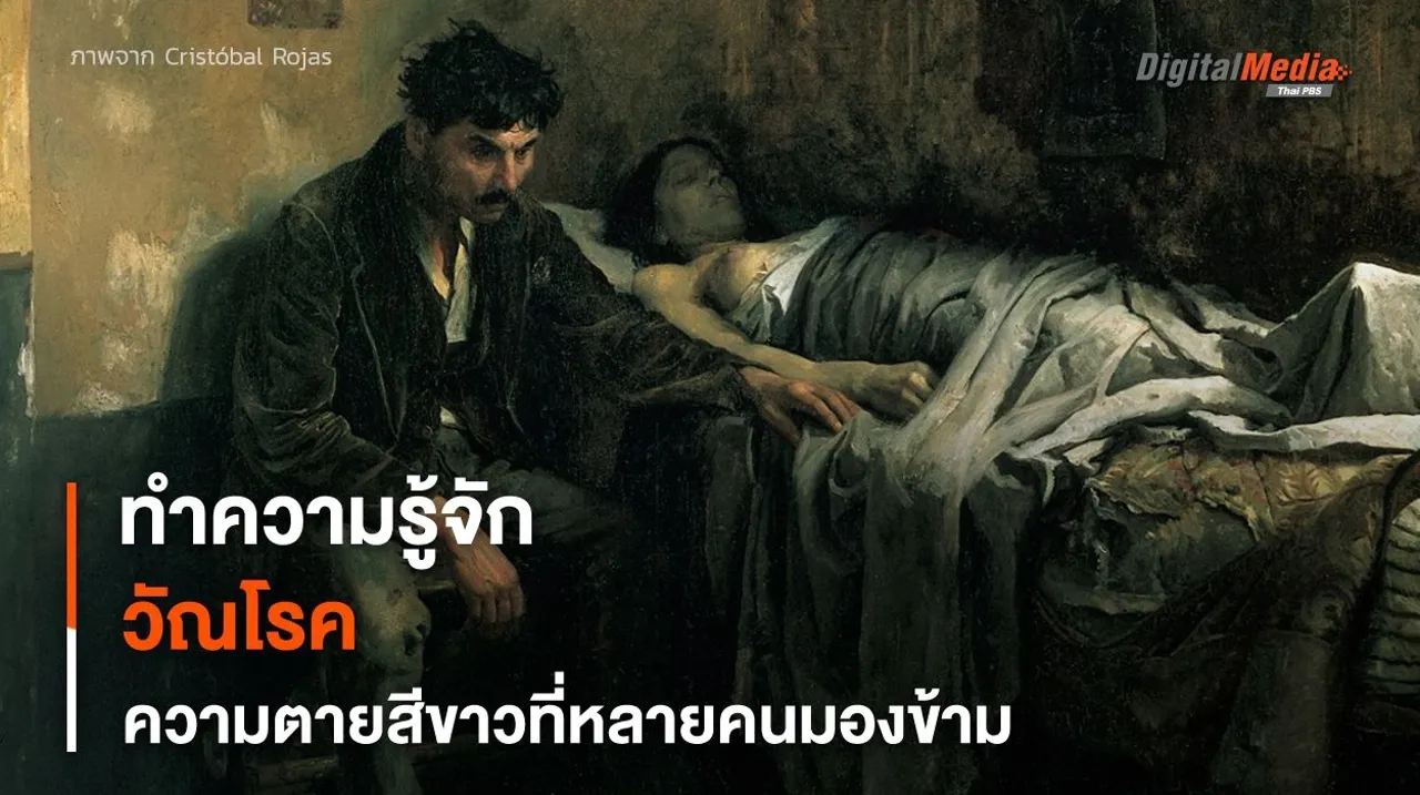 “วัณโรค” ความตายสีขาวที่หลายคนมองข้าม