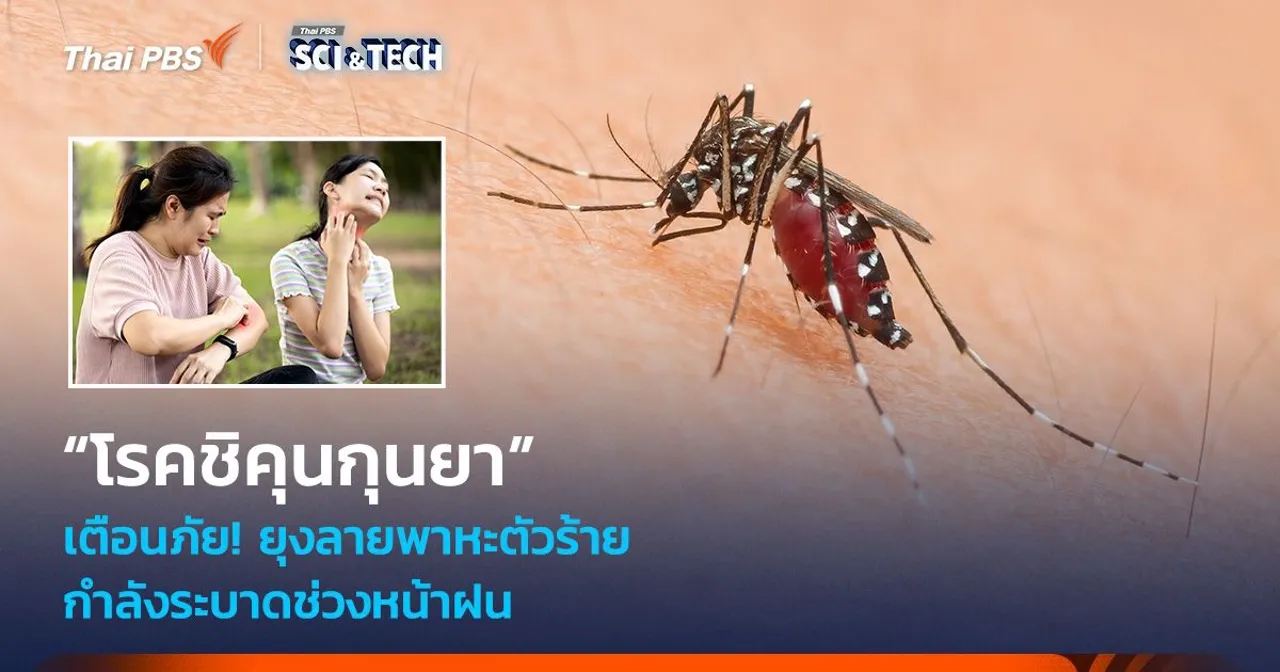 เตือนภัย! ยุงลายพาหะตัวร้าย “โรคชิคุนกุนยา” กำลังระบาดช่วงหน้าฝน
