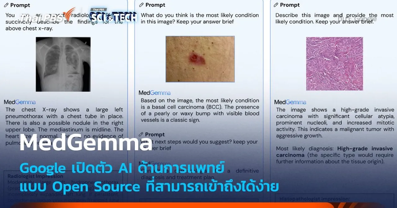 Google เปิดตัว MedGemma AI Opensource ด้านการแพทย์
