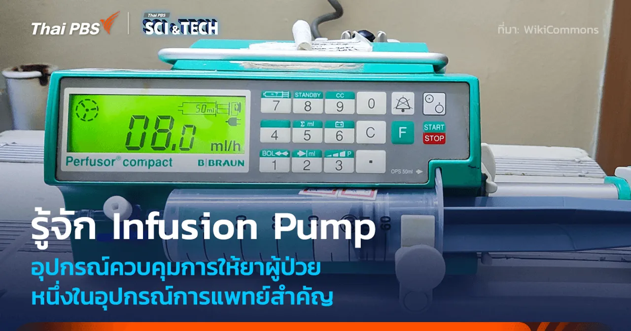 รู้จัก Infusion Pump หนึ่งในอุปกรณ์สำคัญที่สุดในการให้ยากับผู้ป่วย