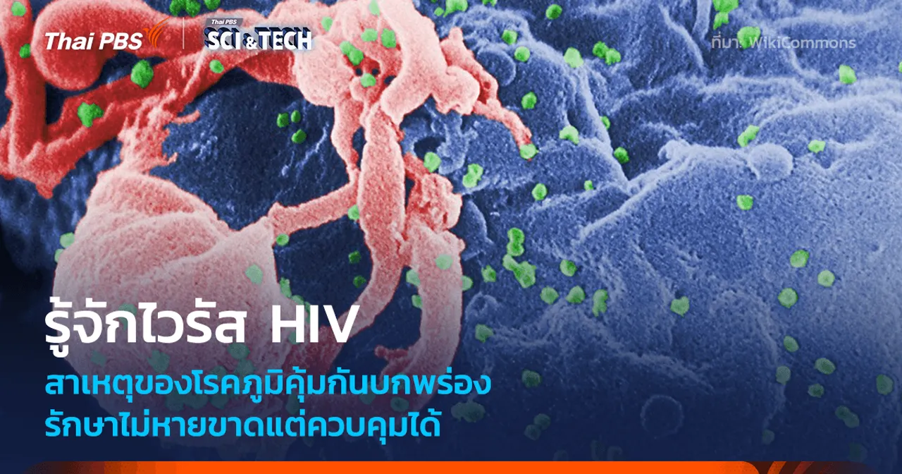 รู้จักไวรัส HIV รักษาไม่หายขาดแต่ควบคุมได้