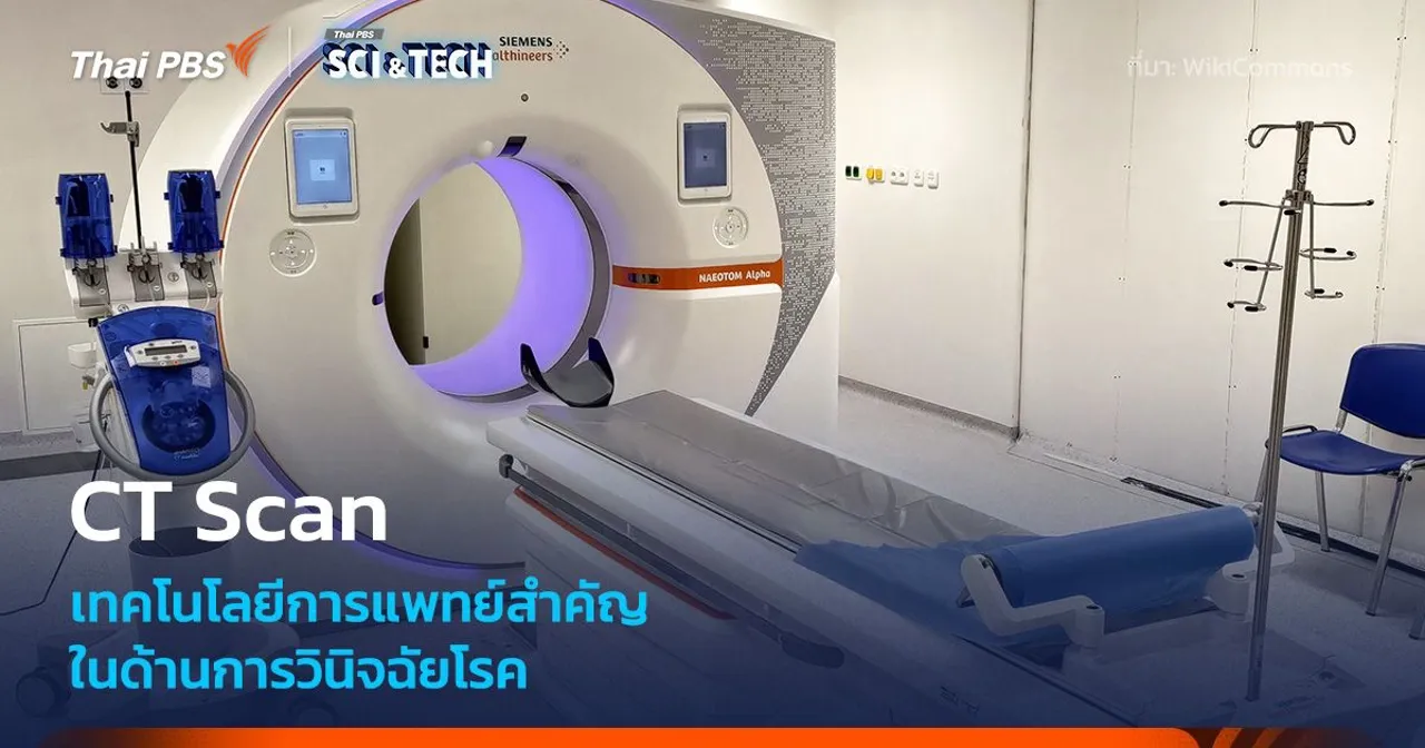 รู้จัก CT Scan หนึ่งในเทคโนโลยีการแพทย์ที่สำคัญสำหรับการวินิจฉัยโรค