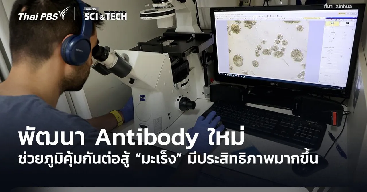 พัฒนา Antibody ใหม่ ช่วยภูมิคุ้มกันต่อสู้ “มะเร็ง” มีประสิทธิภาพมากขึ้น