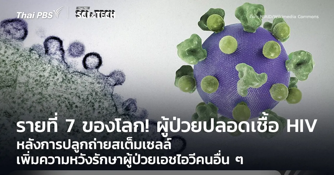 รายที่ 7 ของโลก! ผู้ป่วยปลอดเชื้อ HIV หลังการปลูกถ่ายสเต็มเซลล์
