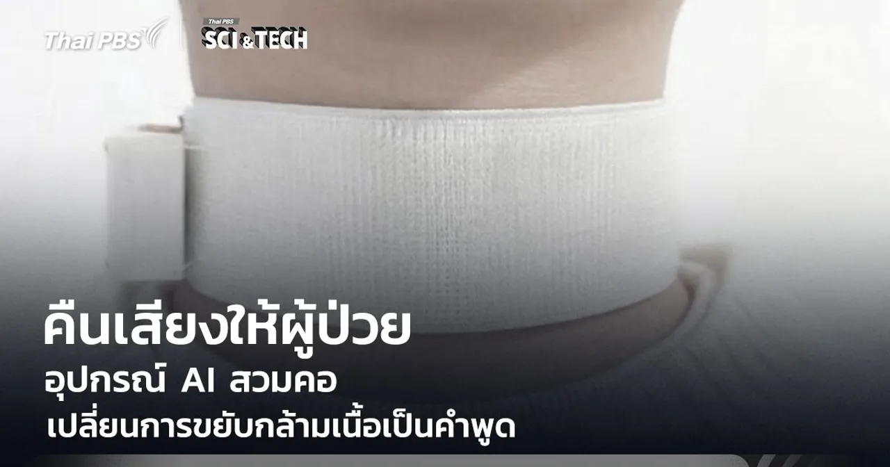 คืนเสียงให้ผู้ป่วย Stroke! อุปกรณ์ AI สวมคอ เปลี่ยนการขยับกล้ามเนื้อเป็นคำพูด สื่อสารได้อีกครั้ง