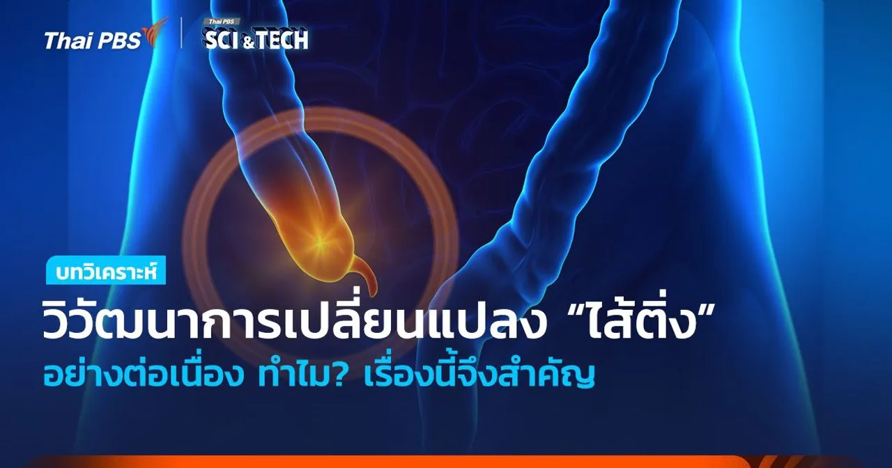 วิวัฒนาการเปลี่ยนแปลง “ไส้ติ่ง” อย่างต่อเนื่อง ทำไม? เรื่องนี้จึงสำคัญ