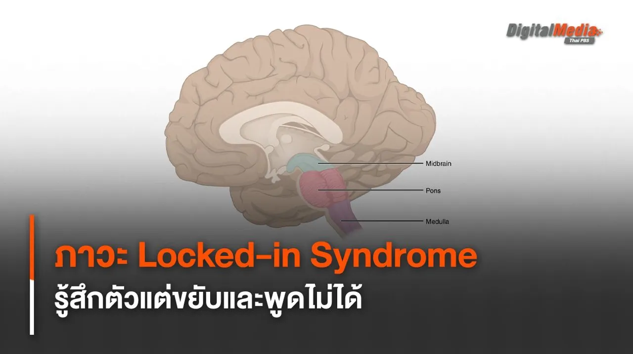 รู้จักภาวะ “Locked-in syndrome” รู้สึกตัวแต่ไม่สามารถขยับได้