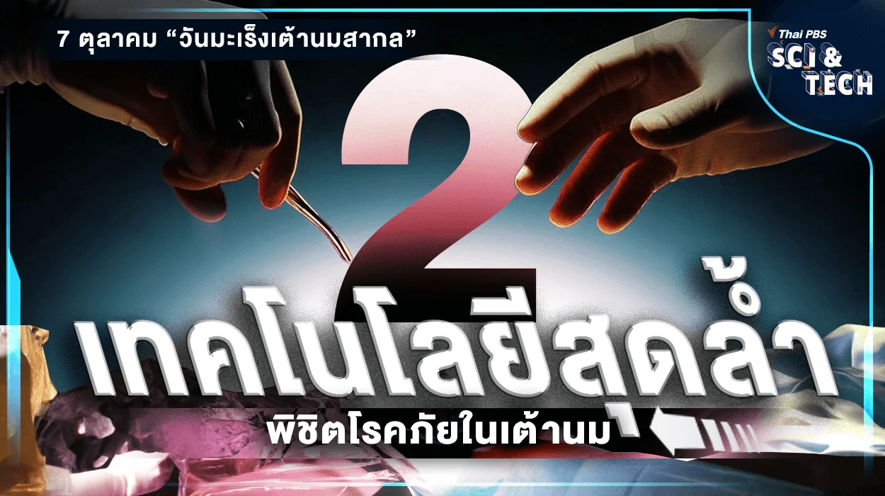 ชวนรู้จัก 2 เทคโนโลยีสุดล้ำ พิชิตโรคภัยในเต้านม
