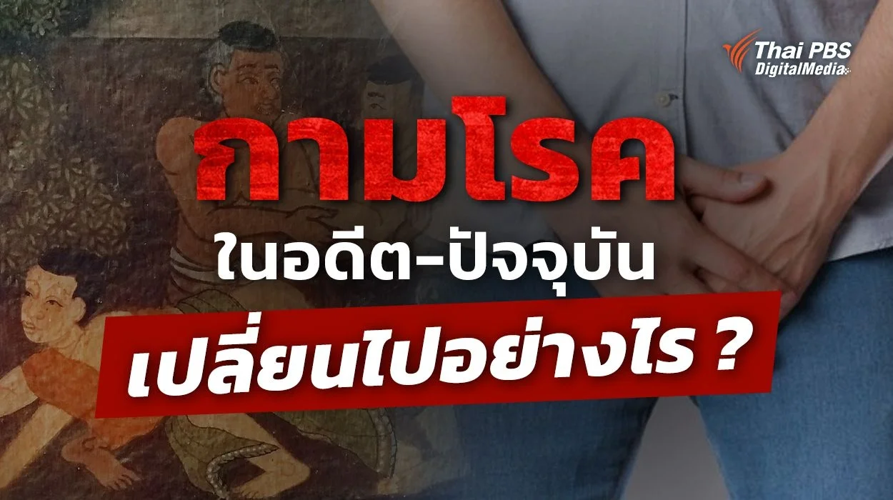 กามโรคในอดีต-ปัจจุบันเปลี่ยนไปอย่างไร ?